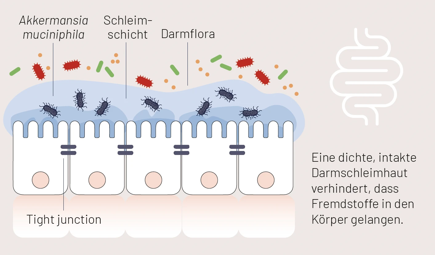 Infografik Darmschleimhaut